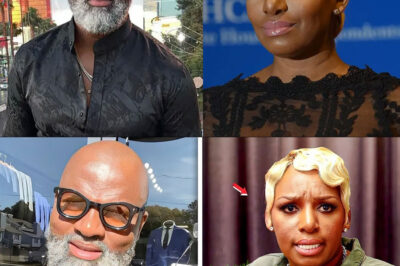 Nene Leakes’s Boyfriend LEAKS Details About Her Plastic Surgeries After Years Of Silence.